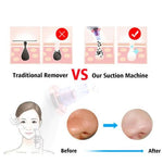Load image into Gallery viewer, Blackhead Removal Suction Tool
